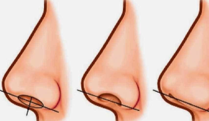على ماذا تدل حجم فتحة الأنف لدى الانسان؟!