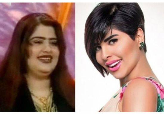 صور صادمة لنجمات.. هكذا كنّ وهكذا أصبحن!