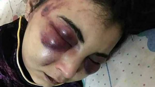 عذب زوجته 3 أيام بوحشية بسبب الفيسبوك!