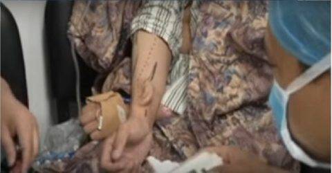 بالفيديو: أذن تنمو على يد رجل..!!