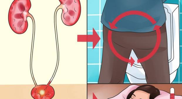 حيلة طبيعية لعلاج إلتهاب المسالك البولية