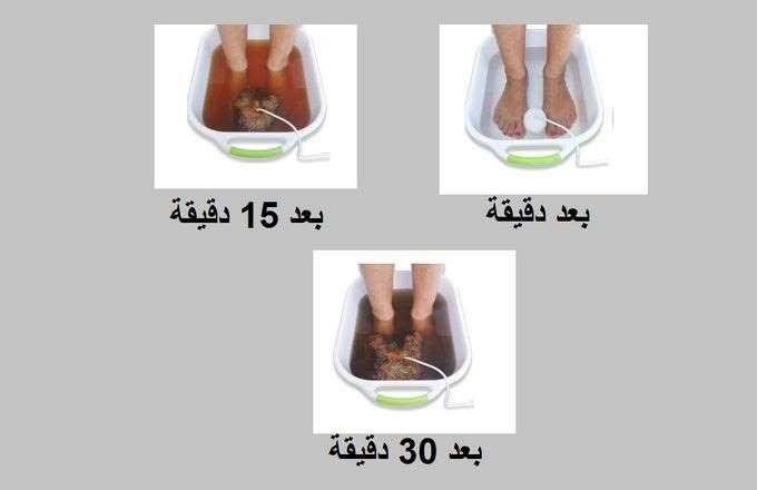 خلطة طبيعية لطرد سموم الجسم من القدمين في 30 دقيقة