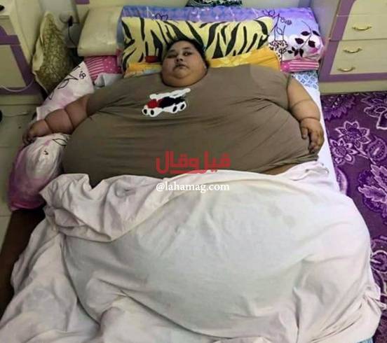 خبر محزن وصادم لأسمن امرأة في العالم... هذا ما توصل إليه الأطباء أخيراً!
