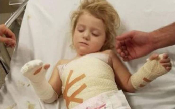 هذه الطفلة كادت أن تخسر يدها بسبب شيء خطير موجود في منازلكم!