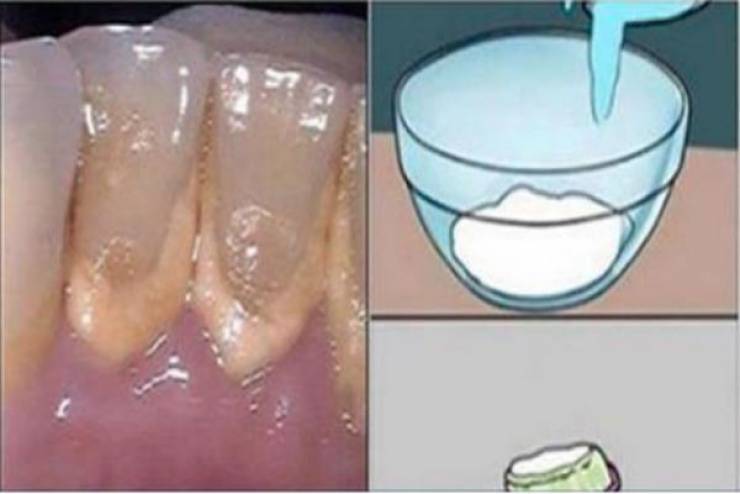غسول الفم هذا يزيل الجير عن الأسنان في دقيقتين
