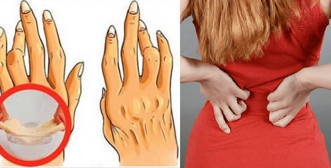 حيلة طبيعية لعلاج عرق النسا والتهاب المفاصل