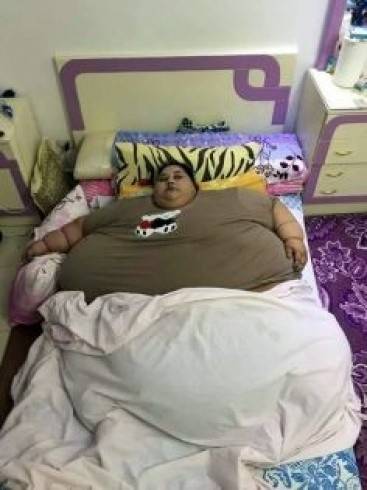صورة نادرة.. شاهدوا كيف كانت أسمن فتاة بالعالم في طفولتها!