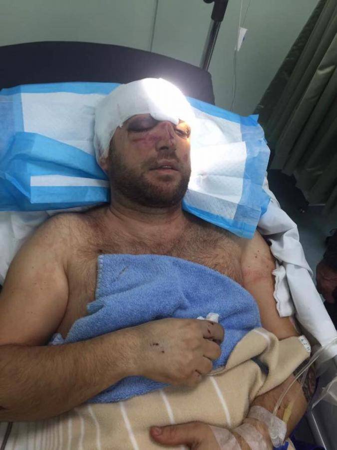 ستيفن حداد يروي تفاصيل الإعتداء.. ضربوني وهدّدوني ورموني مغمىً