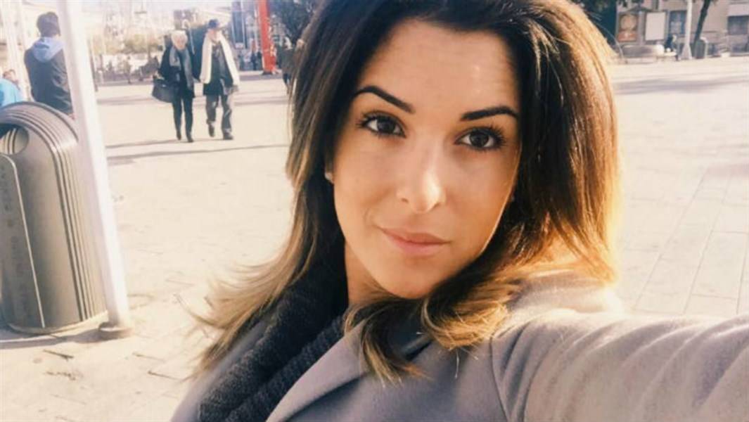 بعد تعرضها لاعتداء من حبيبها العارضة الإيطالية تكشف عن وجهها المشوّه