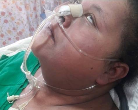 بعد اصابتها بالشلل.. شقيقة أسمن امرأة تكشف حقائق صادمة