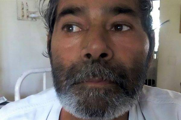 بالصور: لن تُصدّقوا .. كيف دخل 75 مسماراً داخل جسد هذا الرجل!