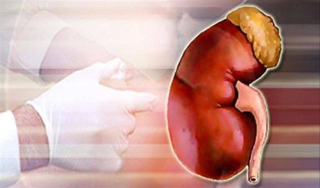 حملة توعية حول أمراض الكلى والبدانة في  أدونيس – جبيل