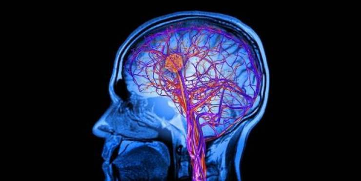 لماذا لا ترتفع درجة حرارة الدماغ أثناء التفكير؟