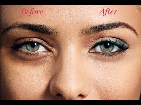 هكذا تتخلصين من الانتفاخ تحت العيون