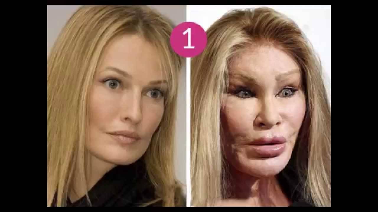 لن تصدّقي ما يمكن لعمليات التجميل أن تتركه من آثار نفسية!