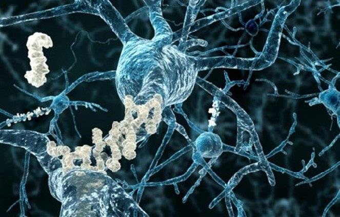 لماذا ارتفعت وفيات الزهايمر بأميركا؟