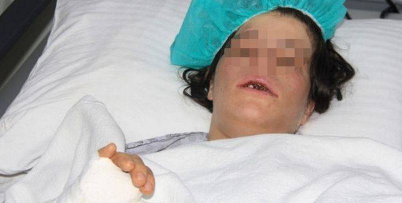 أمام طفليها.. مهندس يعتدي على زوجته بوحشية ويخلع أسنانها ثمّ يفرّ!