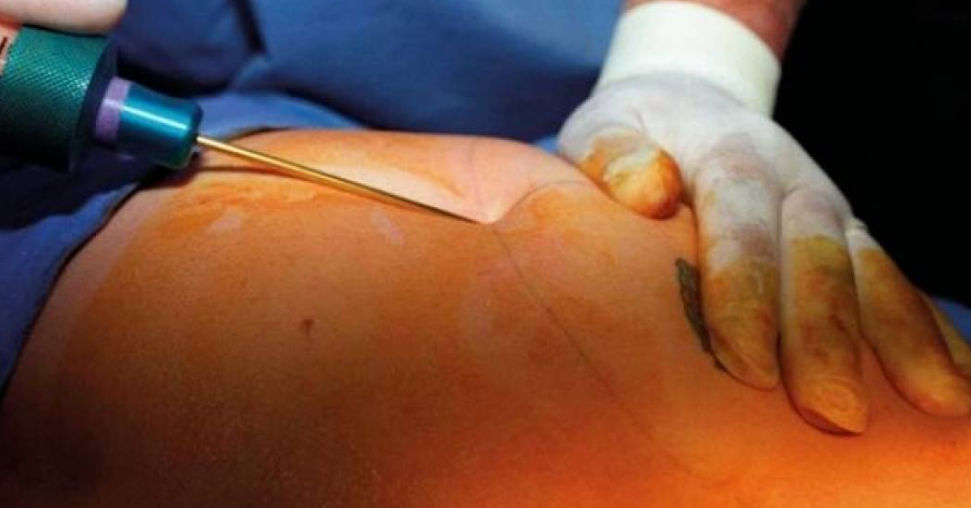 خرجت جثة من مستشفى تجميل معروف... كيف قضت السيّدة الأردنية؟