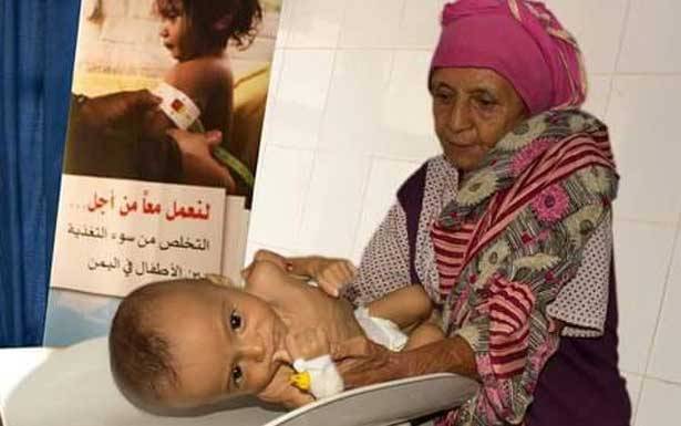 «اليونيسف» : كارثة تُهدّد أطفال اليمن