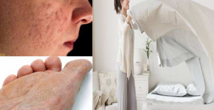 هذا ما سيحدث لجسمك إذا لم تبدّل أغطية سريرك!