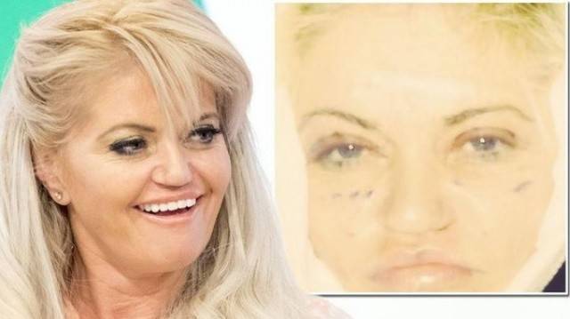 من هي الممثلة التي حولتها عمليات التجميل إلى بلهاء؟