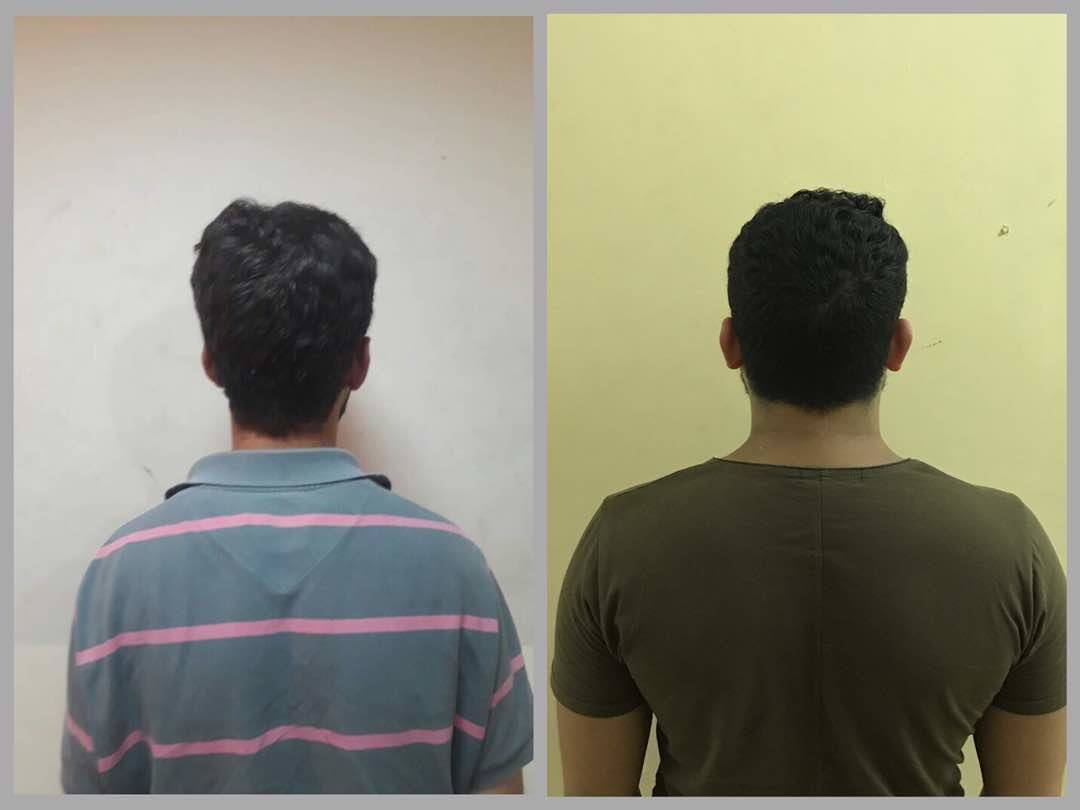 "بلاطة" لسرقة الدراجات.. آخر ابتكارات السارقَين