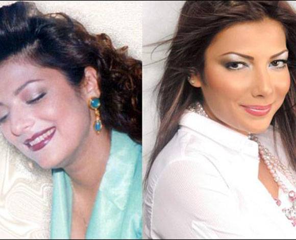 صور صادمة - شفاه النجمات قبل وبعد التجميل