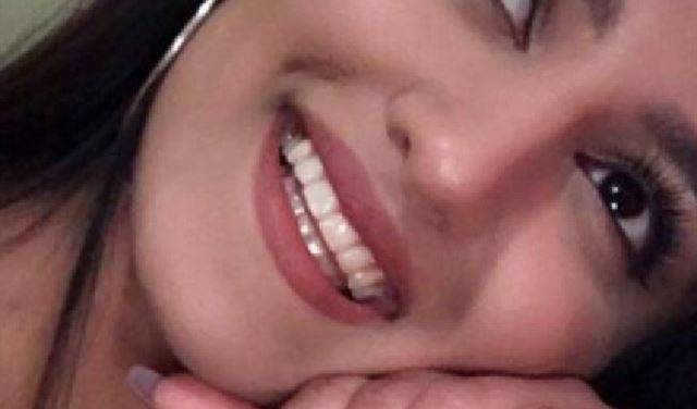بالصور..عارضة أزياء تتعرض لهجوم بمادة حارقة في لندن