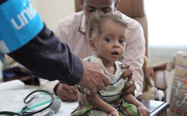 الجامعة العربية : لإنقاذ 7 ملايين يمني من المجاعة