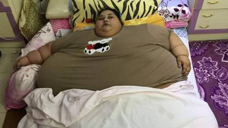 شاهدوا كيف أصبحت المصرية صاحبة النصف طن بعد العلاج!