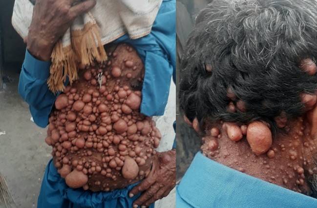 صوره تقشعر لها الأبدان لكن قصته مأسوية.. تعرّفوا الى "رجل الفقاعات"