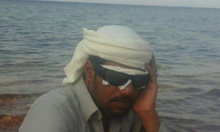 بالصور.. اقتلعوا عينيه لإجباره على تطليق زوجته!
