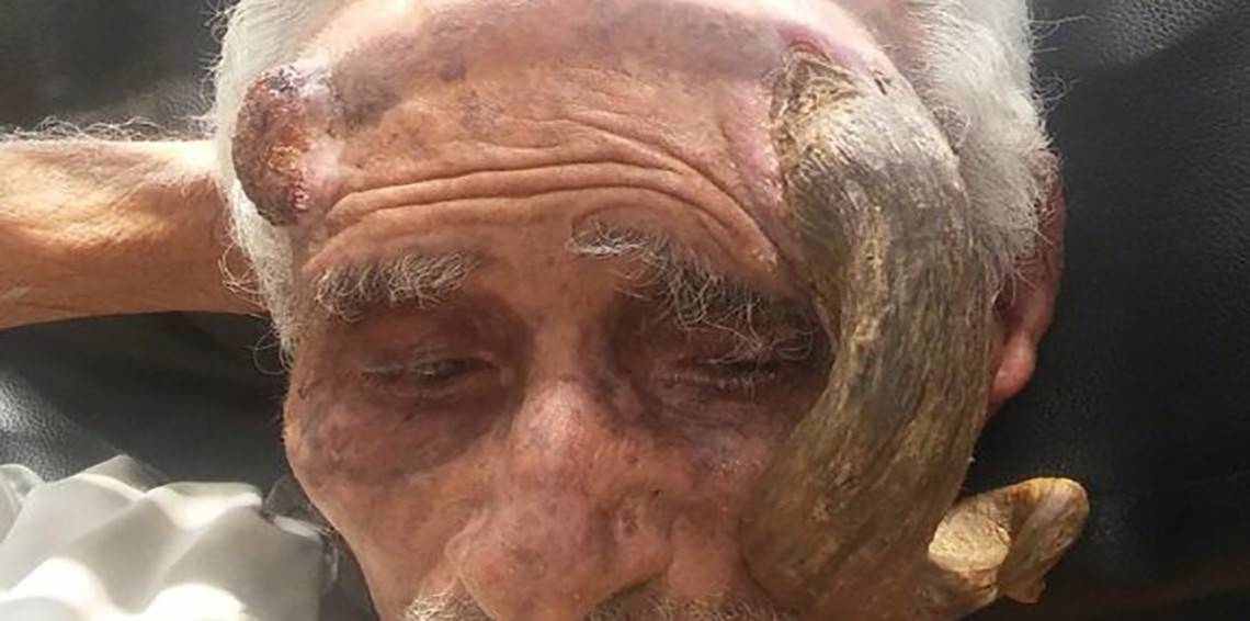 بالفيديو.. هكذا تسبّبوا بقتل المعمِّر صاحب "القرن"!
