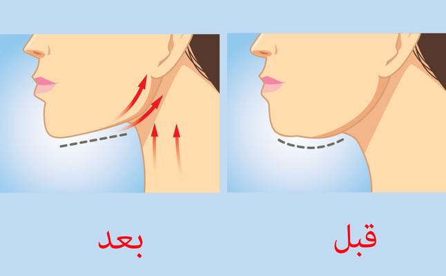 وداعًا للذقن المزدوج بفضل هذه المادة السحرية!
