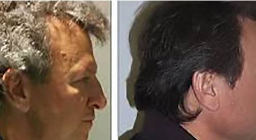 في حادثة غريبة: دواء جديد للسرطان.. هذا ما يفعله