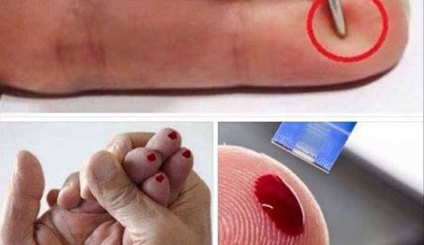 هكذا يمكنك إنقاذ إنسان من السكتة الدماغية !!