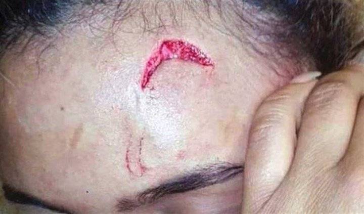 بالصور - هذا ما فعلته السيدة الأولى بعارضة أزياء..!