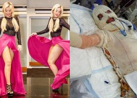 صور مخيفة لـ"دانا" الشقراء.. ظنّتها "نتالي" عشيقة زوجها فانتقمت بطريقة بشعة!