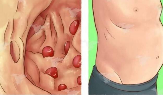 هذا ما يتسبب في انتفاخ معدتكم.. عادات تقومون بها يوميا!