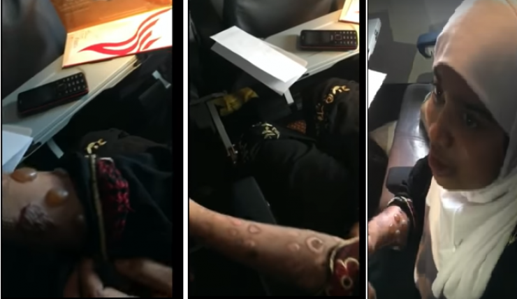 شاهد ..سعودية تعتدي على خادمتها بطريقة وحشية وتكويها بالنار!