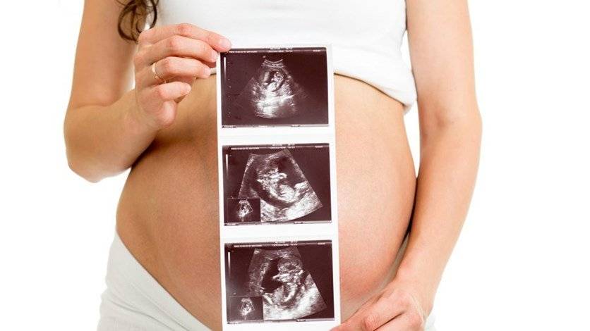 صورة بالموجات الصوتية لحامل تجتاح الإنترنت... ماذا ظهر إلى جانب الجنين؟