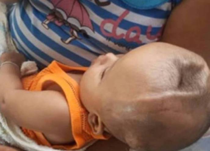 تخلى عنه والداه بعد ولادته بحفرة في أعلى رأسه.. وهذا ما حدث لاحقاً!