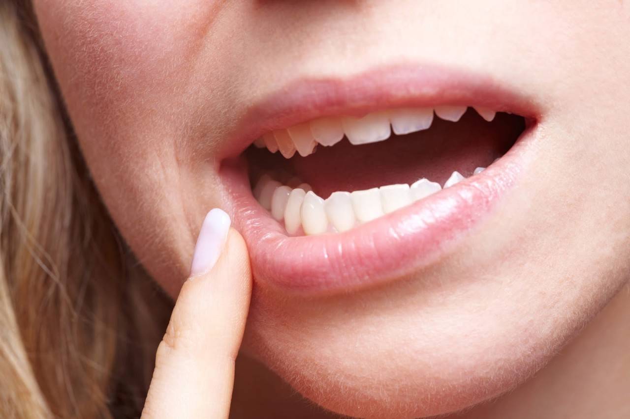 ضعوا هذا المكوّن في فمكم.. لتقوية اللثة وتماسك الأسنان