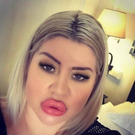 بعد إدمانها عمليات التجميل.. شاهدوا كيف تحولت إلى 