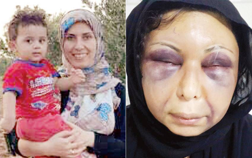 سوريّة عذّبها زوجها ليتزوّج غيرها.. وابنتها شاهدتها غارقة في دمائها - فيديو