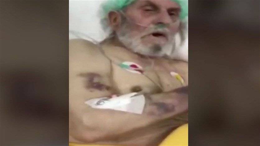 ممرضات أعطين سيجارة لمريض مسن...فيديو صادم!