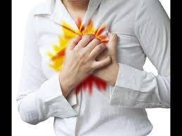 هذه الأمور تدلّ على حرقة المعدة.. اليكم نصائح للتخلّص منها