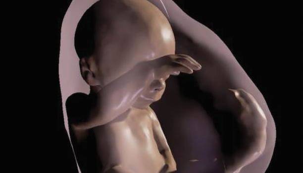 العثور على جنين ميت في بطن شقيقه التوأم: كيف حصلت المأساة؟