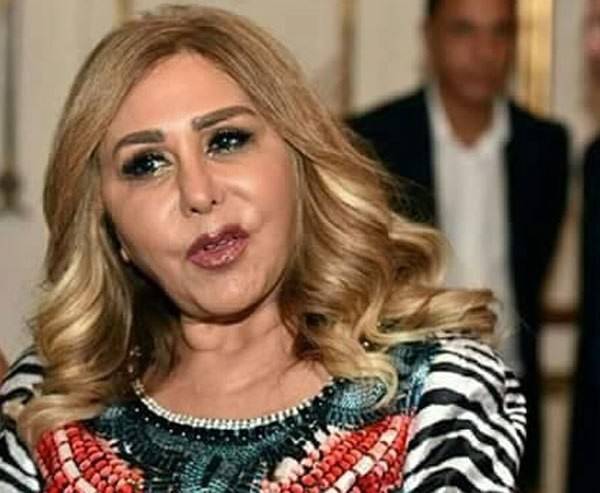 بالصورة: بعد خطأ من طبيب التجميل.. هكذا أصبحت مها المصري