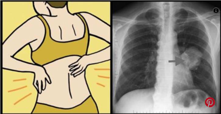 تنبيه هام : إذا ظهرت عليكم هذه الأعراض فأنتم مصابون بمرض خبيث!